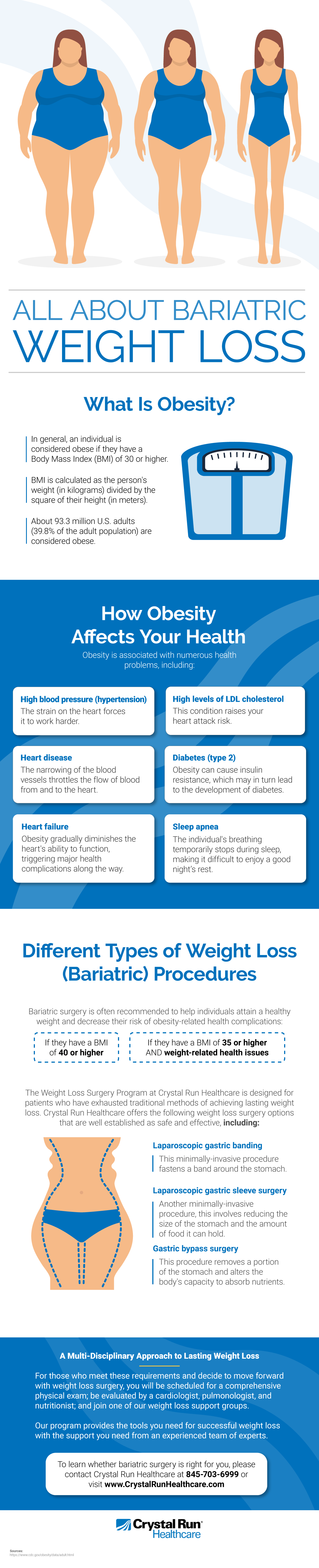 All About Bariatric Weight Loss Infographic