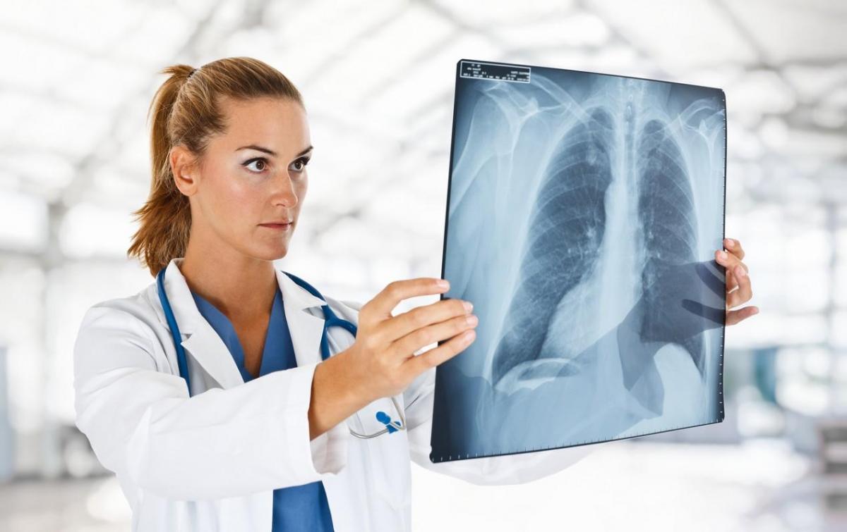 doctor examining a lung radiography