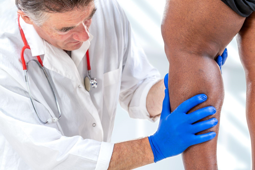 phlebologists examination -Varicose veins on the womans legs close up