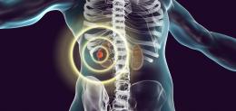 D-illustration-showing-presence-of-cancerous-tumor-inside-kidney-tissue