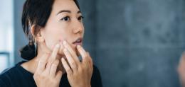 Woman examining acne in mirror and squeezing blemish, illustrating difference between acne and pimples for skincare and dermatology blog.