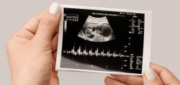 An expectant mother examines a printed sonogram capture