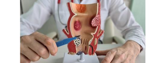 surgery