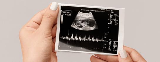An expectant mother examines a printed sonogram capture